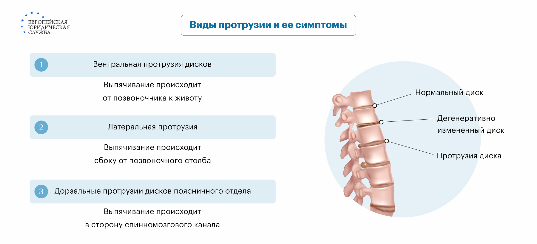 Протрузия поясничного отдела позвоночника