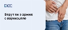 Берут ли в армию с варикоцеле