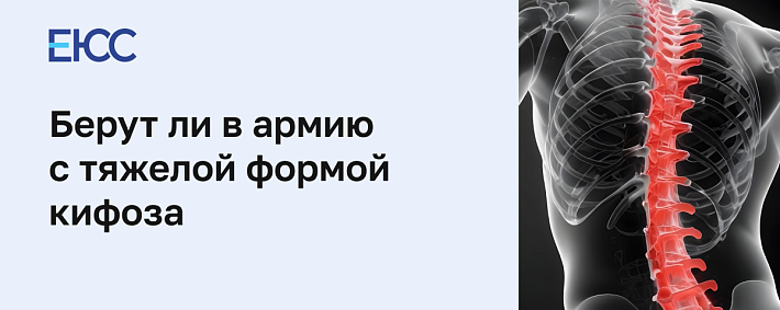 Берут ли в армию с кифозом