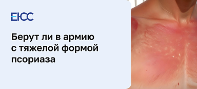 Берут ли в армию с псориазом